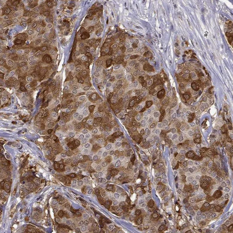 Immunohistochemistry (Formalin/PFA-fixed paraffin-embedded sections) - Anti-PHGDH/Malate dehydrogenase antibody (AB211365)
