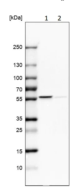 Western blot - Anti-PHGDH/Malate dehydrogenase antibody (AB211365)