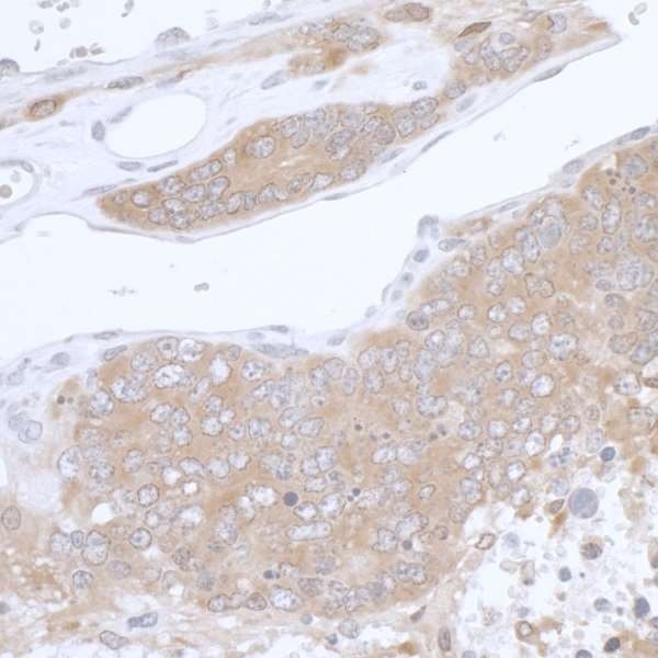 Immunohistochemistry (Formalin/PFA-fixed paraffin-embedded sections) - Anti-PHGDH/Malate dehydrogenase antibody (AB240744), expandable thumbnail