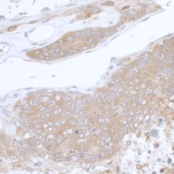 Immunohistochemistry (Formalin/PFA-fixed paraffin-embedded sections) - Anti-PHGDH/Malate dehydrogenase antibody (AB240744)