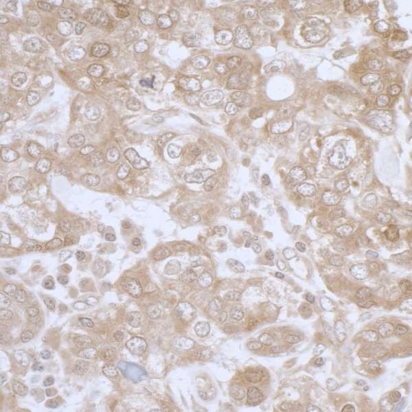 Immunohistochemistry (Formalin/PFA-fixed paraffin-embedded sections) - Anti-PHGDH/Malate dehydrogenase antibody (AB240744), expandable thumbnail