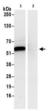 Immunoprecipitation - Anti-PHGDH/Malate dehydrogenase antibody (AB240744), expandable thumbnail