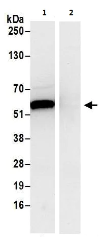 Immunoprecipitation - Anti-PHGDH/Malate dehydrogenase antibody (AB240744)