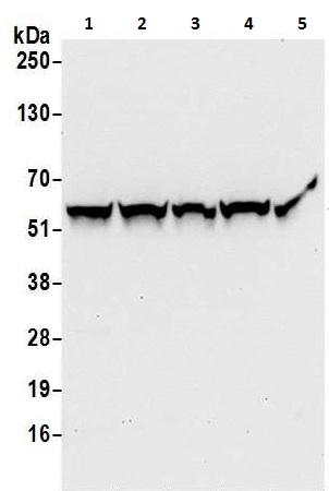 Western blot - Anti-PHGDH/Malate dehydrogenase antibody (AB240744), expandable thumbnail