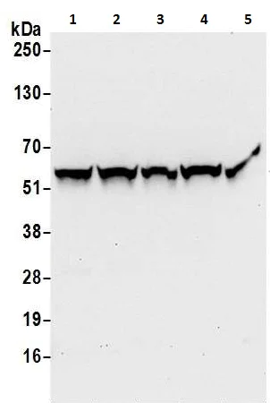 Western blot - Anti-PHGDH/Malate dehydrogenase antibody (AB240744)