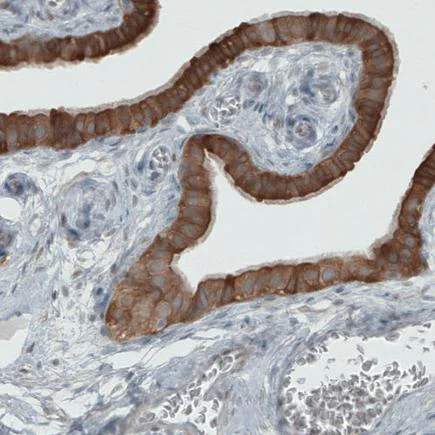 Immunohistochemistry (Formalin/PFA-fixed paraffin-embedded sections) - Anti-PHGDH/Malate dehydrogenase antibody [CL0555] (AB236763)