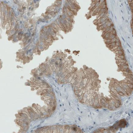 Immunohistochemistry (Formalin/PFA-fixed paraffin-embedded sections) - Anti-PHGDH/Malate dehydrogenase antibody [CL0555] (AB236763)