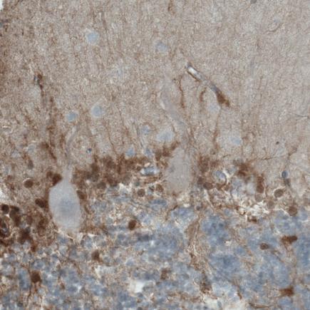 Immunohistochemistry (Formalin/PFA-fixed paraffin-embedded sections) - Anti-PHGDH/Malate dehydrogenase antibody [CL0555] (AB236763)