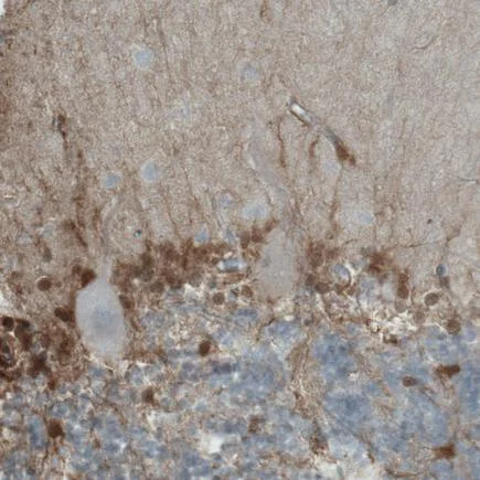 Immunohistochemistry (Formalin/PFA-fixed paraffin-embedded sections) - Anti-PHGDH/Malate dehydrogenase antibody [CL0555] (AB236763)