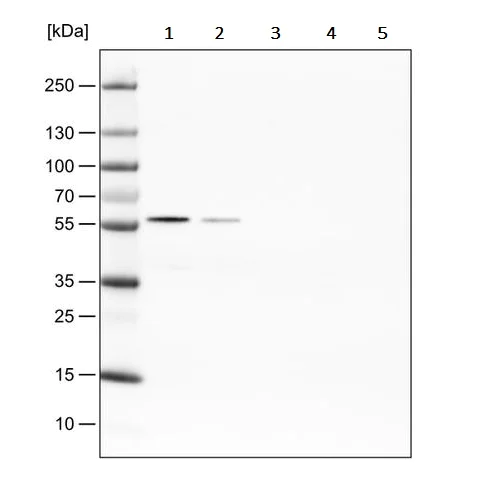 Western blot - Anti-PHGDH/Malate dehydrogenase antibody [CL0555] (AB236763)