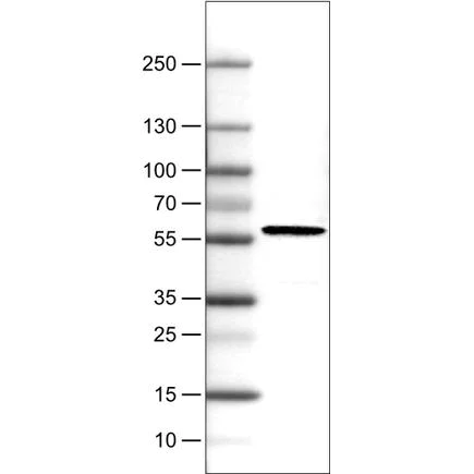 Western blot - Anti-PHGDH/Malate dehydrogenase antibody [CL0555] (AB236763)