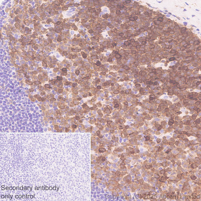 Immunohistochemistry (Formalin/PFA-fixed paraffin-embedded sections) - Anti-PHGDH/Malate dehydrogenase antibody [EPR28634-1] (AB324530)