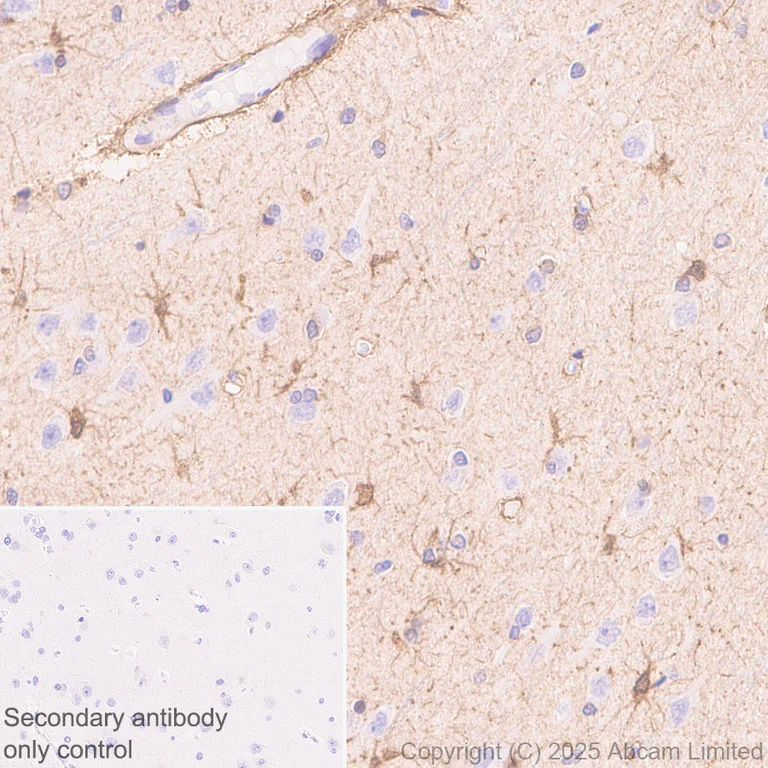 Immunohistochemistry (Formalin/PFA-fixed paraffin-embedded sections) - Anti-PHGDH/Malate dehydrogenase antibody [EPR28634-1] (AB324530)