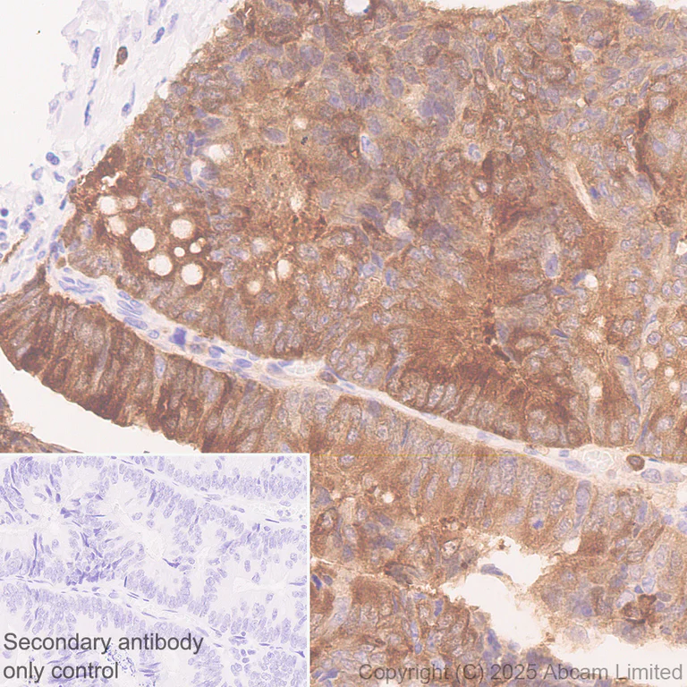 Immunohistochemistry (Formalin/PFA-fixed paraffin-embedded sections) - Anti-PHGDH/Malate dehydrogenase antibody [EPR28634-1] (AB324530)