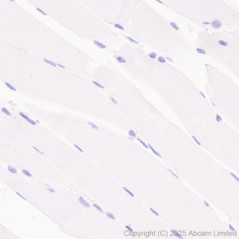 Immunohistochemistry (Formalin/PFA-fixed paraffin-embedded sections) - Anti-PHGDH/Malate dehydrogenase antibody [EPR28634-1] (AB324530)
