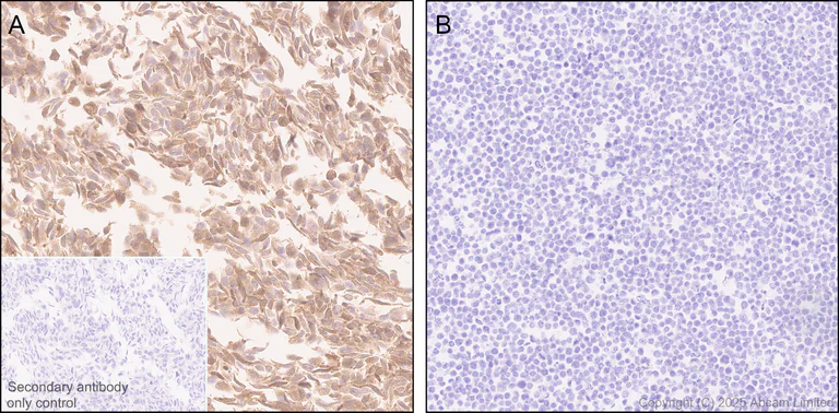 Immunohistochemistry (Formalin/PFA-fixed paraffin-embedded sections) - Anti-PHGDH/Malate dehydrogenase antibody [EPR28634-1] (AB324530)