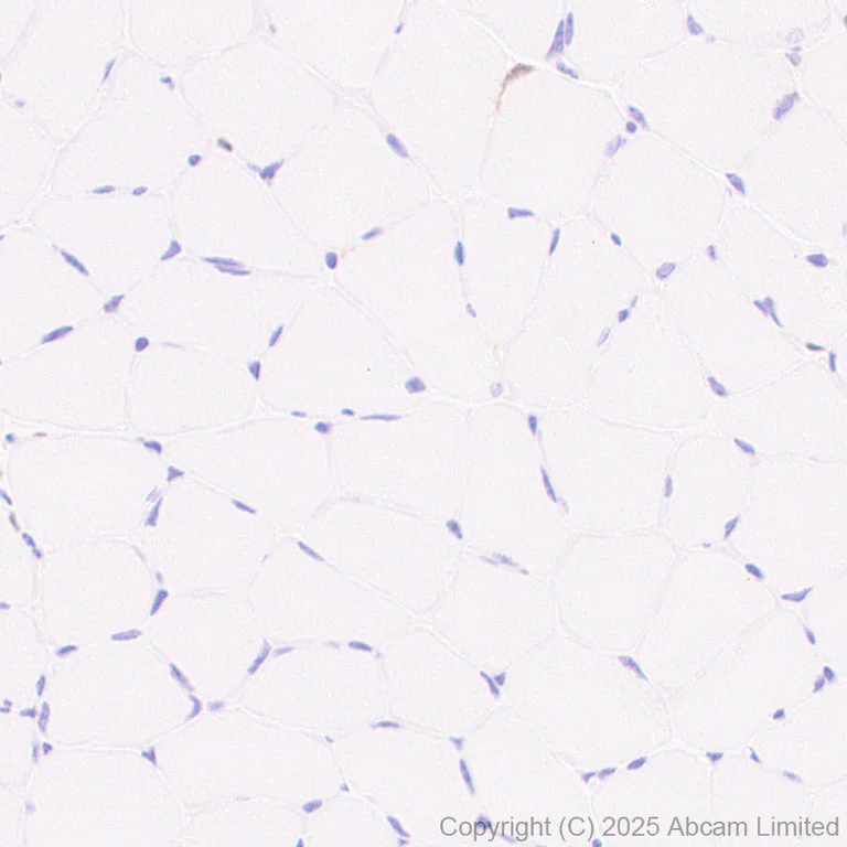 Immunohistochemistry (Formalin/PFA-fixed paraffin-embedded sections) - Anti-PHGDH/Malate dehydrogenase antibody [EPR28634-1] (AB324530)