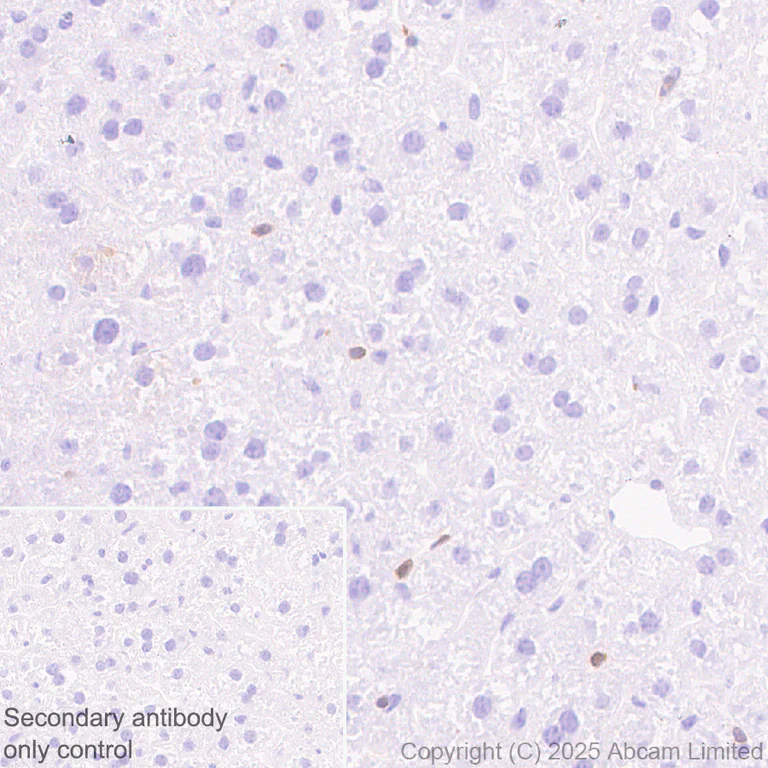 Immunohistochemistry (Formalin/PFA-fixed paraffin-embedded sections) - Anti-PHGDH/Malate dehydrogenase antibody [EPR28634-1] (AB324530)