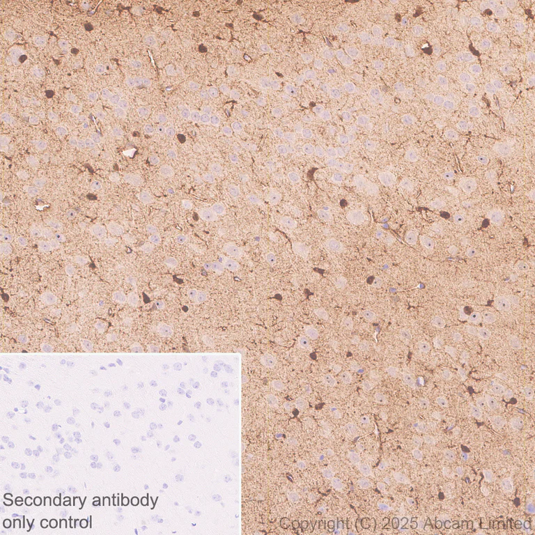 Immunohistochemistry (Formalin/PFA-fixed paraffin-embedded sections) - Anti-PHGDH/Malate dehydrogenase antibody [EPR28634-1] (AB324530)