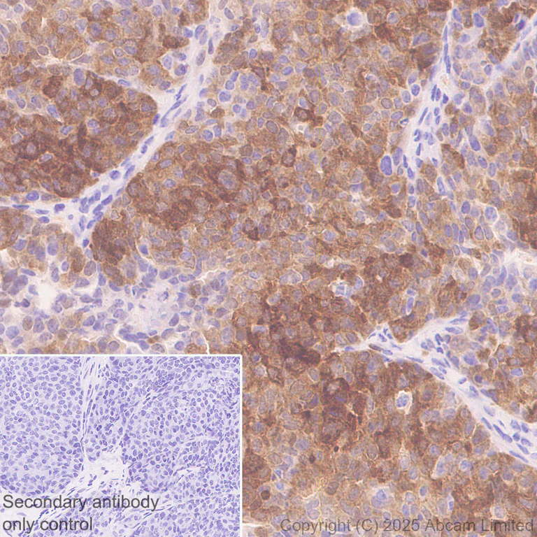 Immunohistochemistry (Formalin/PFA-fixed paraffin-embedded sections) - Anti-PHGDH/Malate dehydrogenase antibody [EPR28634-1] (AB324530)