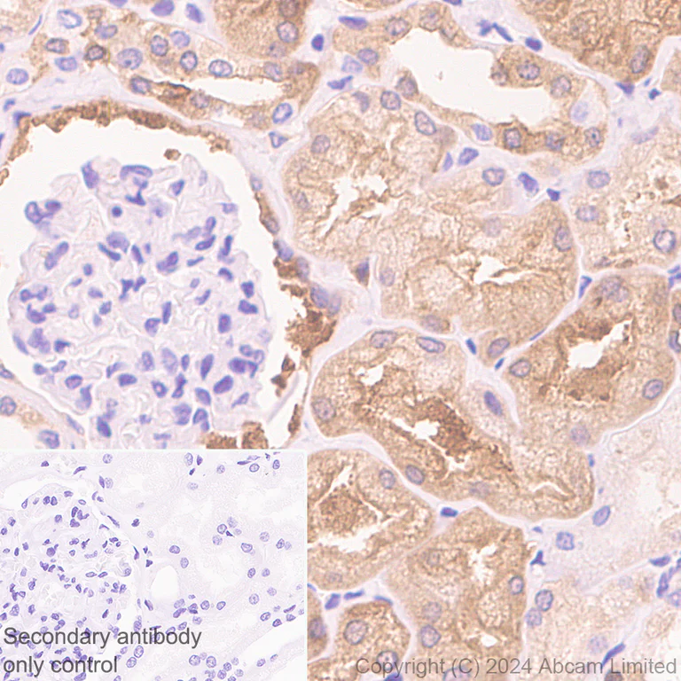 Immunohistochemistry (Formalin/PFA-fixed paraffin-embedded sections) - Anti-PHGDH/Malate dehydrogenase antibody [EPR28634-20] (AB322270)
