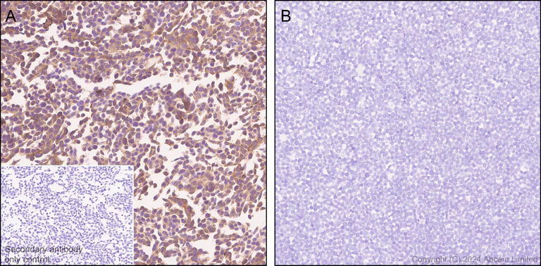 Immunohistochemistry (Formalin/PFA-fixed paraffin-embedded sections) - Anti-PHGDH/Malate dehydrogenase antibody [EPR28634-20] (AB322270)