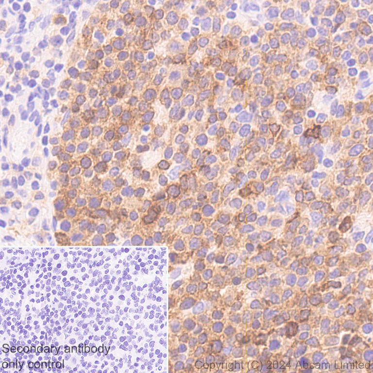 Immunohistochemistry (Formalin/PFA-fixed paraffin-embedded sections) - Anti-PHGDH/Malate dehydrogenase antibody [EPR28634-20] - BSA and Azide free (AB324835)