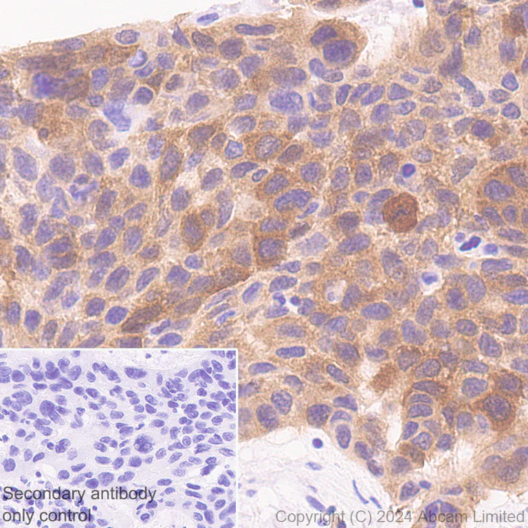 Immunohistochemistry (Formalin/PFA-fixed paraffin-embedded sections) - Anti-PHGDH/Malate dehydrogenase antibody [EPR28634-20] - BSA and Azide free (AB324835)