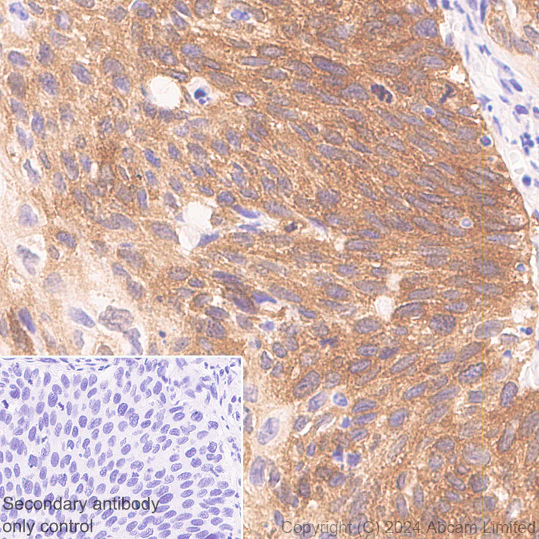 Immunohistochemistry (Formalin/PFA-fixed paraffin-embedded sections) - Anti-PHGDH/Malate dehydrogenase antibody [EPR28634-20] - BSA and Azide free (AB324835)