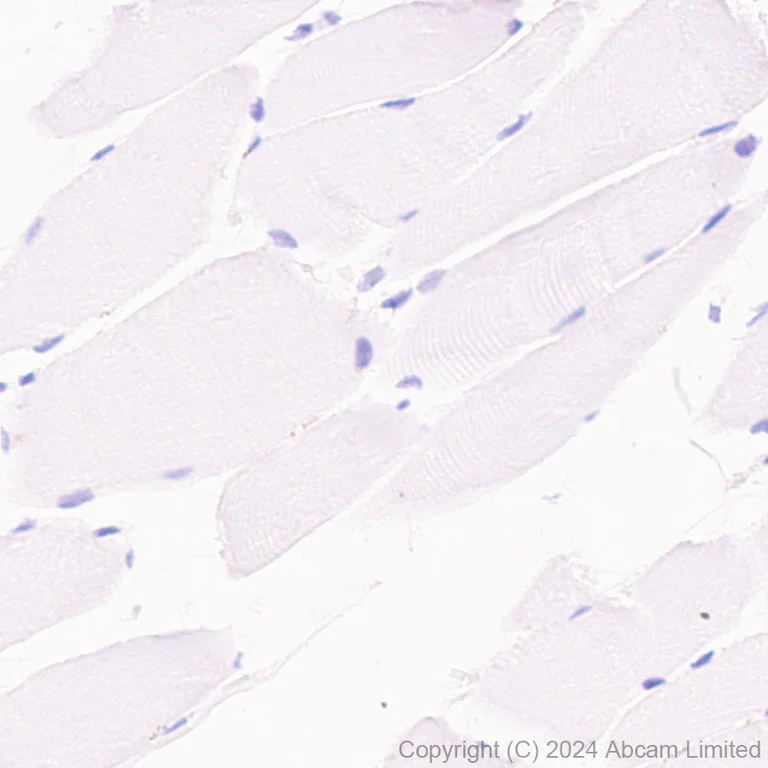 Immunohistochemistry (Formalin/PFA-fixed paraffin-embedded sections) - Anti-PHGDH/Malate dehydrogenase antibody [EPR28634-20] - BSA and Azide free (AB324835)