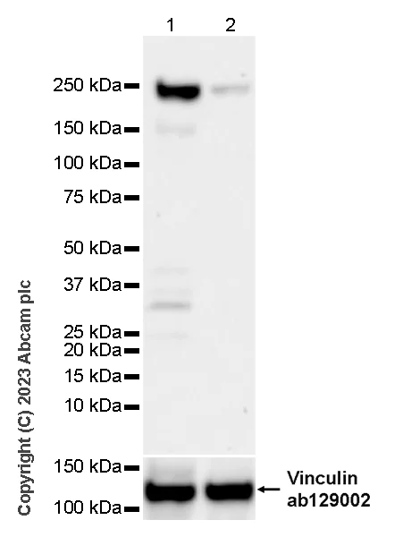 Western blot - Anti-PHIP antibody [EPR27150-82] (AB309962)