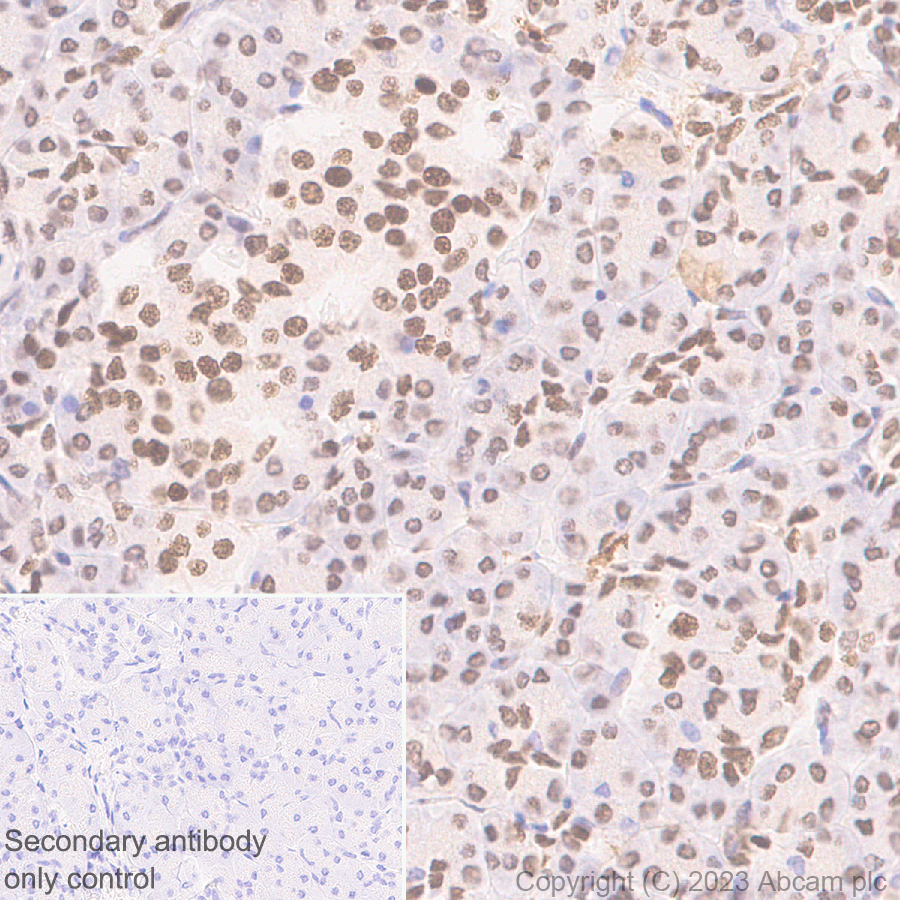 Immunohistochemistry (Formalin/PFA-fixed paraffin-embedded sections) - Anti-PHIP antibody [EPR27150-82] - BSA and Azide free (ab309963), expandable thumbnail