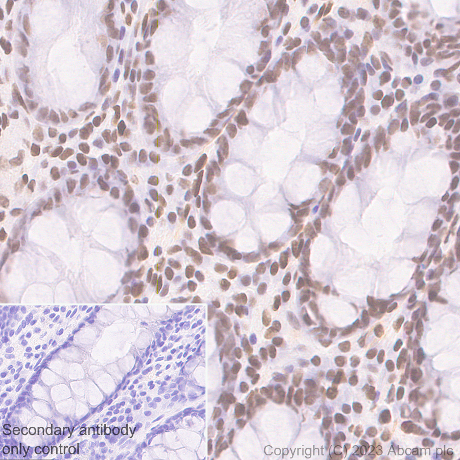 Immunohistochemistry (Formalin/PFA-fixed paraffin-embedded sections) - Anti-PHIP antibody [EPR27150-82] - BSA and Azide free (ab309963), expandable thumbnail