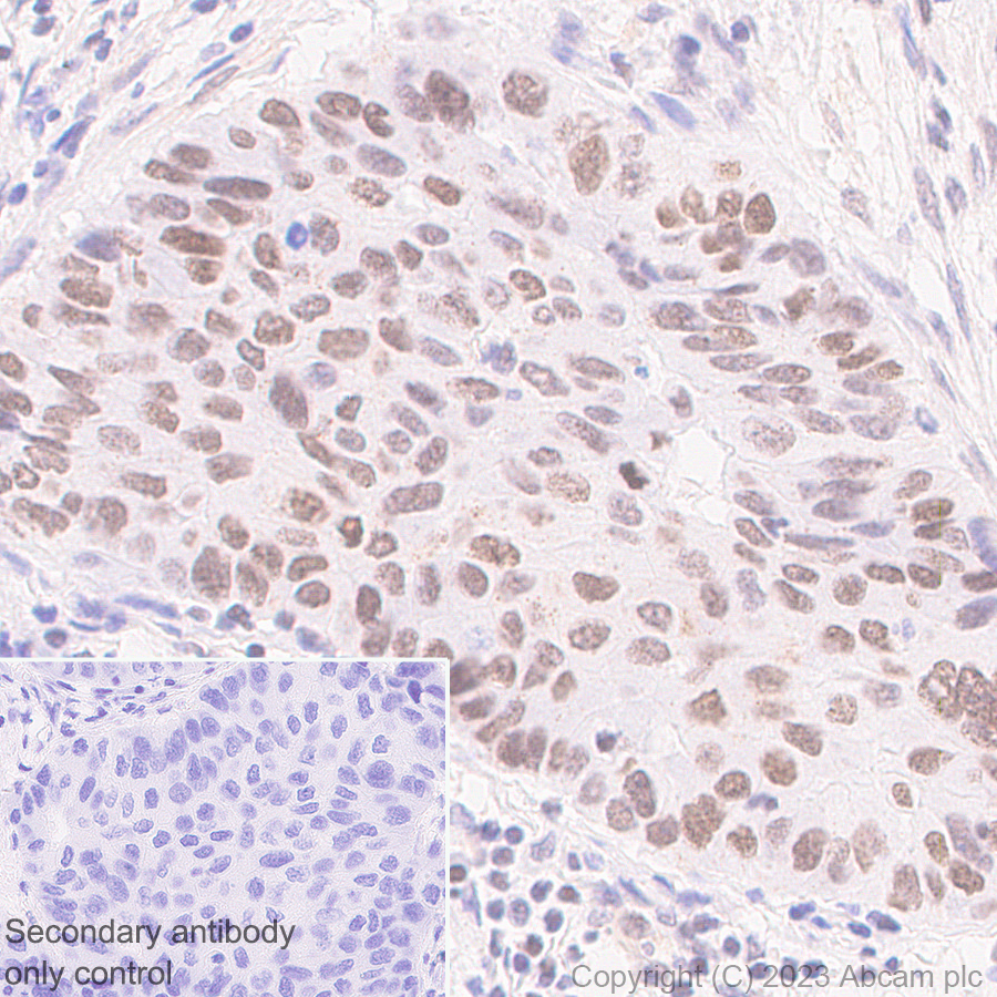 Immunohistochemistry (Formalin/PFA-fixed paraffin-embedded sections) - Anti-PHIP antibody [EPR27150-82] - BSA and Azide free (ab309963), expandable thumbnail