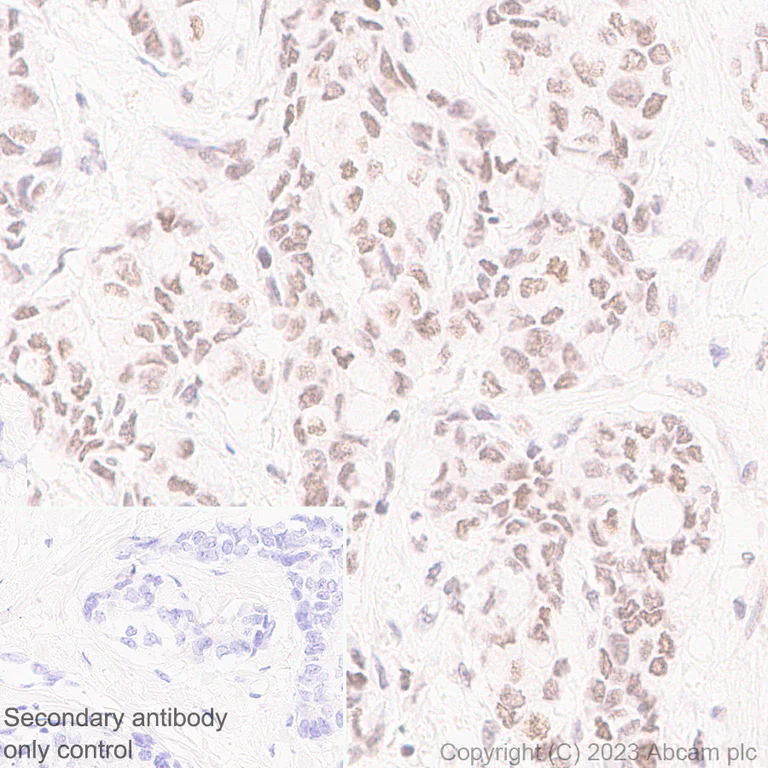 Immunohistochemistry (Formalin/PFA-fixed paraffin-embedded sections) - Anti-PHIP antibody [EPR27150-82] - BSA and Azide free (AB309963)