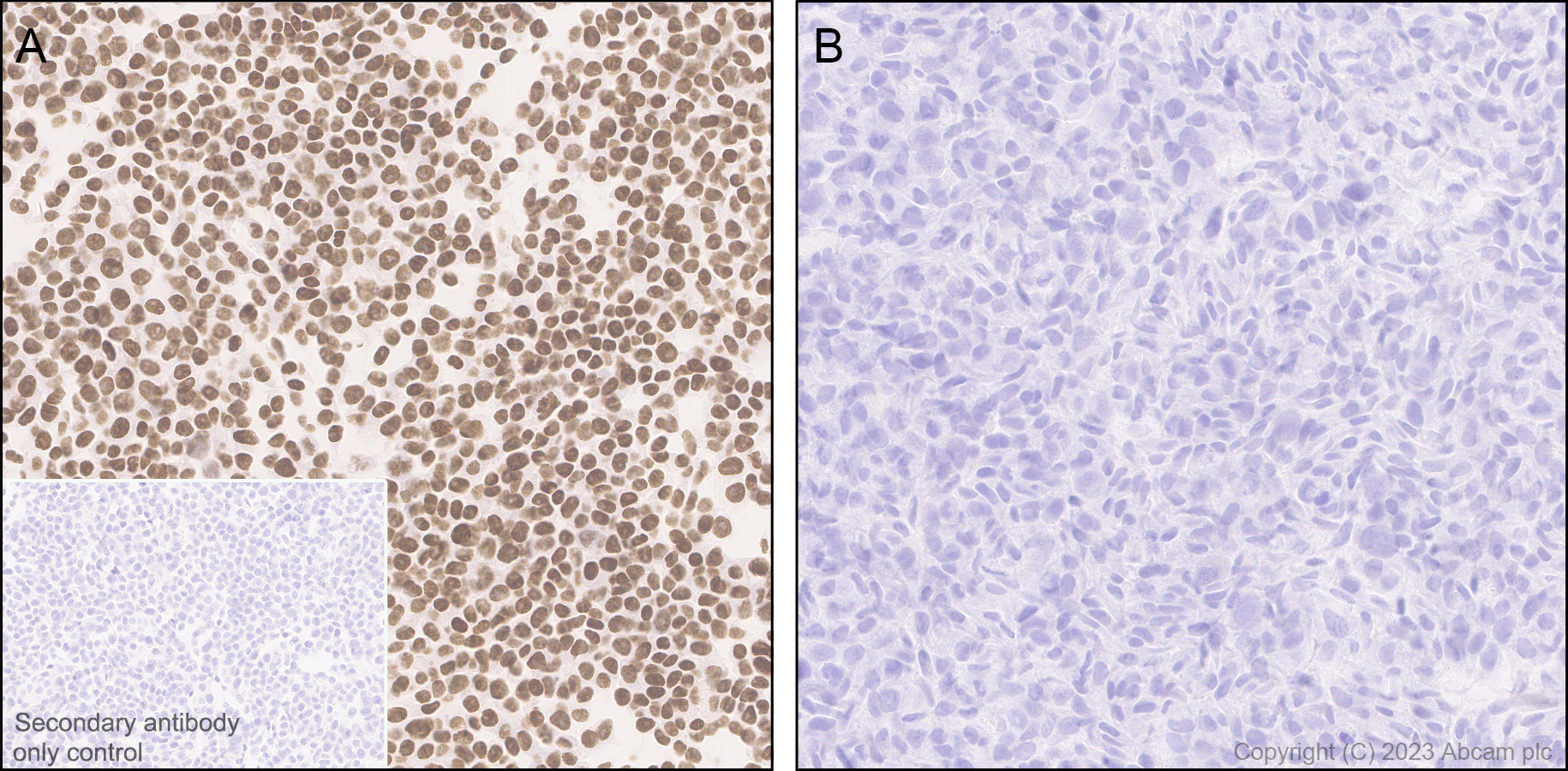 Immunohistochemistry (Formalin/PFA-fixed paraffin-embedded sections) - Anti-PHIP antibody [EPR27150-82] - BSA and Azide free (ab309963), expandable thumbnail