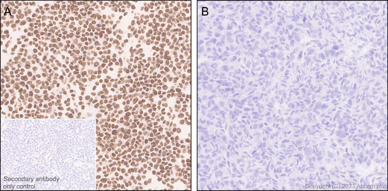 Immunohistochemistry (Formalin/PFA-fixed paraffin-embedded sections) - Anti-PHIP antibody [EPR27150-82] - BSA and Azide free (AB309963)