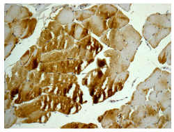 Immunohistochemistry (Formalin/PFA-fixed paraffin-embedded sections) - Anti-PHKA1 antibody [EPR12118] (AB176338), expandable thumbnail