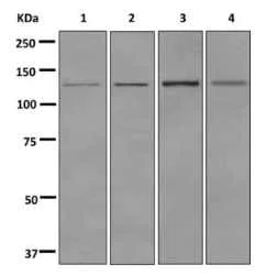 Western blot - Anti-PHKA1 antibody [EPR12118] - BSA and Azide free (AB249913)