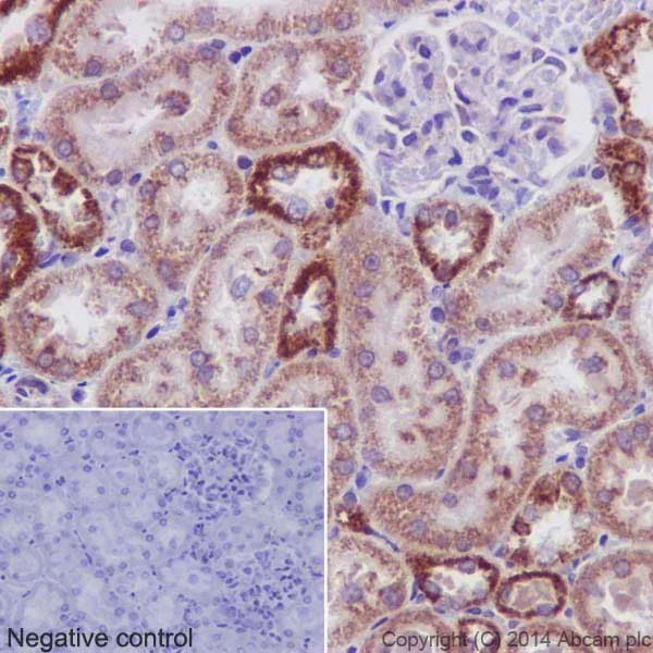 Immunohistochemistry (Formalin/PFA-fixed paraffin-embedded sections) - Anti-PHKG1 antibody [EPR14812] (AB194112)
