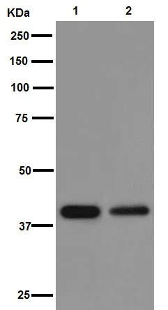 Western blot - Anti-PHKG1 antibody [EPR14812] (AB194112)