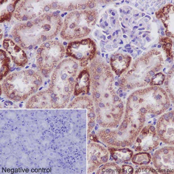 Immunohistochemistry (Formalin/PFA-fixed paraffin-embedded sections) - Anti-PHKG1 antibody [EPR14812] - BSA and Azide free (AB251179), expandable thumbnail