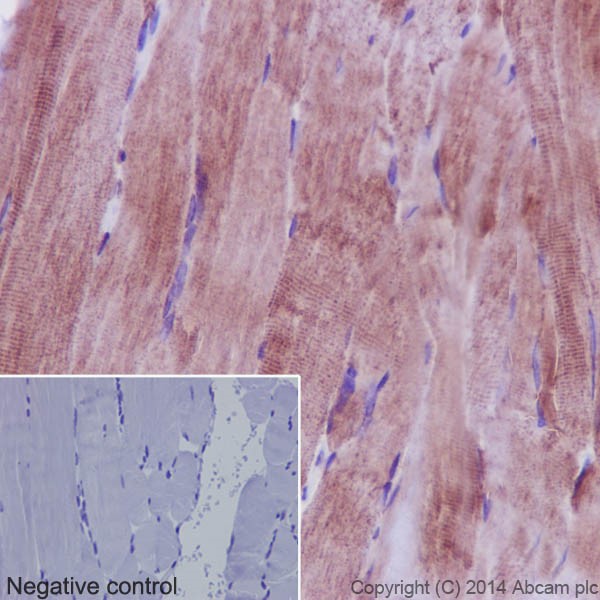 Immunohistochemistry (Formalin/PFA-fixed paraffin-embedded sections) - Anti-PHKG1 antibody [EPR14812] - BSA and Azide free (AB251179), expandable thumbnail
