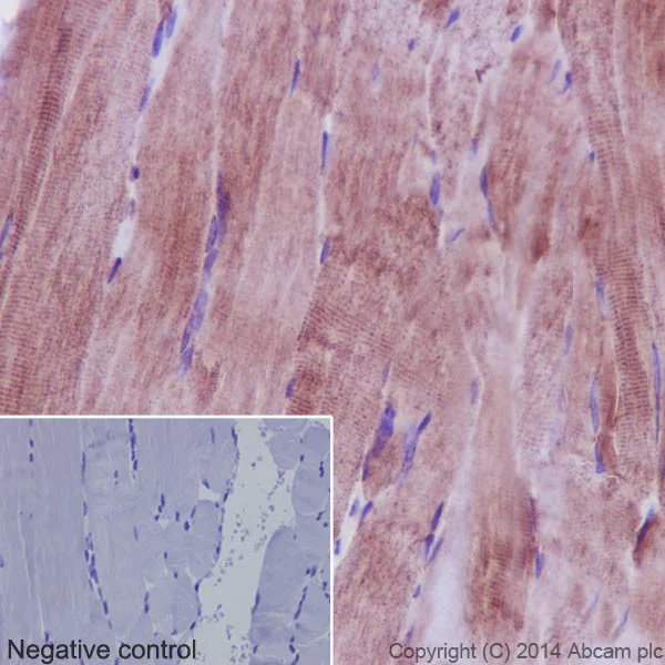 Immunohistochemistry (Formalin/PFA-fixed paraffin-embedded sections) - Anti-PHKG1 antibody [EPR14812] - BSA and Azide free (AB251179)