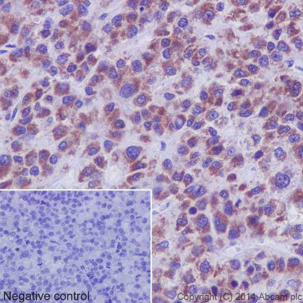 Immunohistochemistry (Formalin/PFA-fixed paraffin-embedded sections) - Anti-PHKG1 antibody [EPR14812] - BSA and Azide free (AB251179)