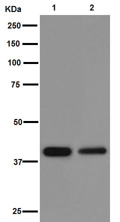 Western blot - Anti-PHKG1 antibody [EPR14812] - BSA and Azide free (AB251179), expandable thumbnail