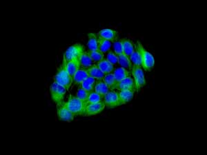 Immunocytochemistry/ Immunofluorescence - Anti-PHKG2 antibody [EPR9727] - BSA and Azide free (AB249435), expandable thumbnail