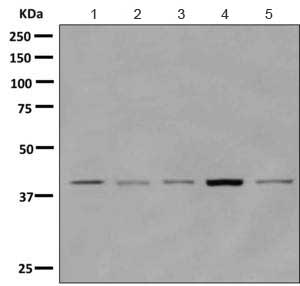 Western blot - Anti-PHKG2 antibody [EPR9727] - BSA and Azide free (AB249435), expandable thumbnail