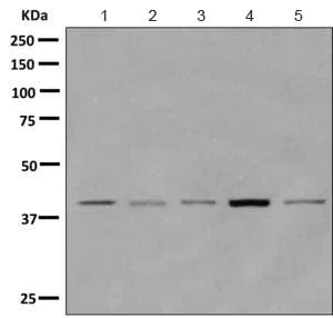 Western blot - Anti-PHKG2 antibody [EPR9727] - BSA and Azide free (AB249435)