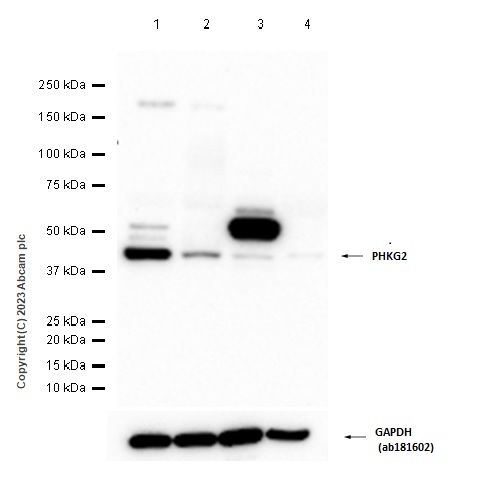 Western blot - Anti-PHKG2 antibody [EPR9727] - BSA and Azide free (AB249435), expandable thumbnail